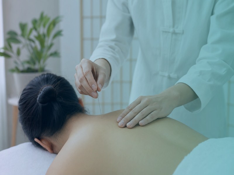 Acupuncture
